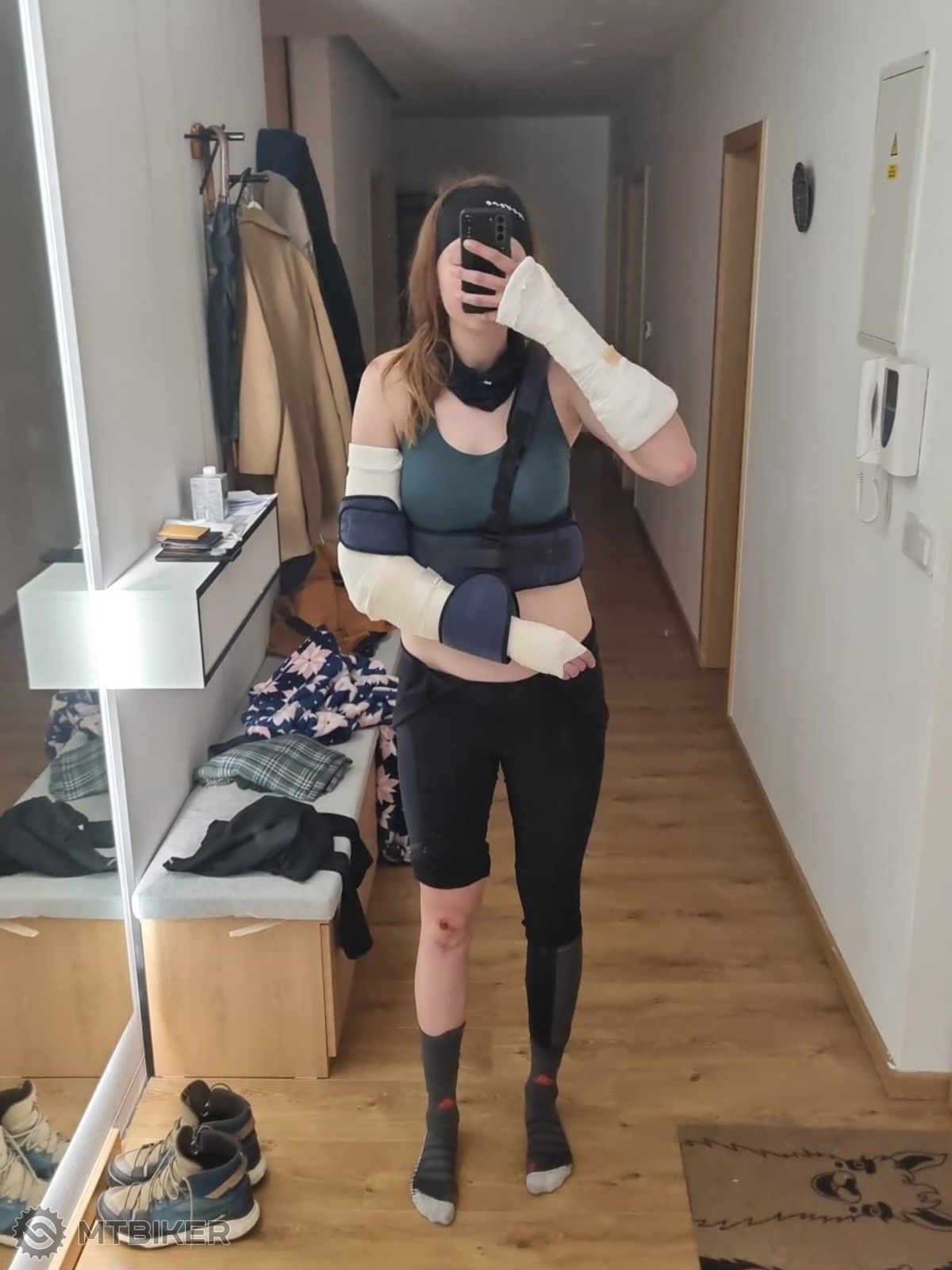 cyklistka doma po nehode