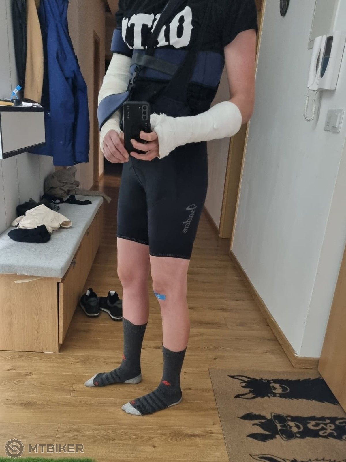 cyklistka po nehode